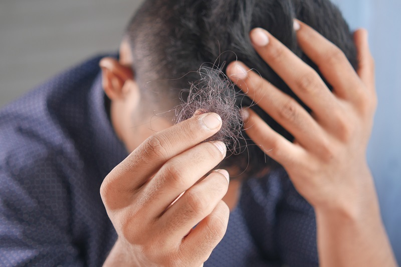 Saw Palmetto for hair loss: Does it work