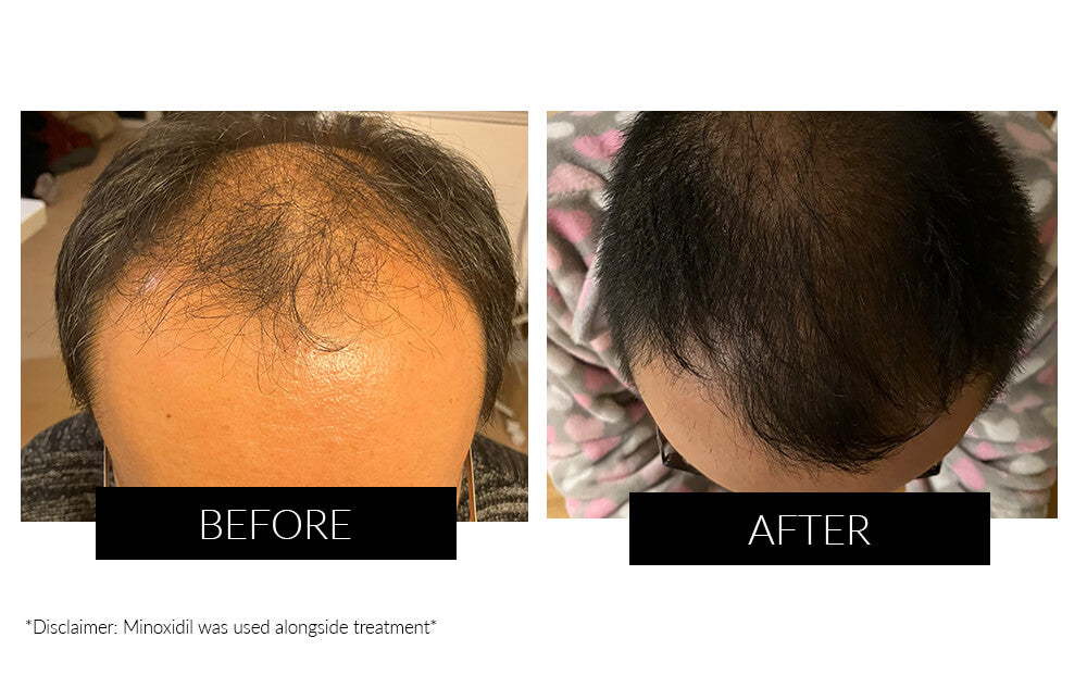 before and after treatment