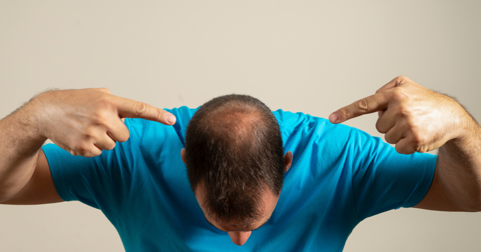 how-to-stop-hair-loss-in-teenage-guys-expert-tips-and-advice