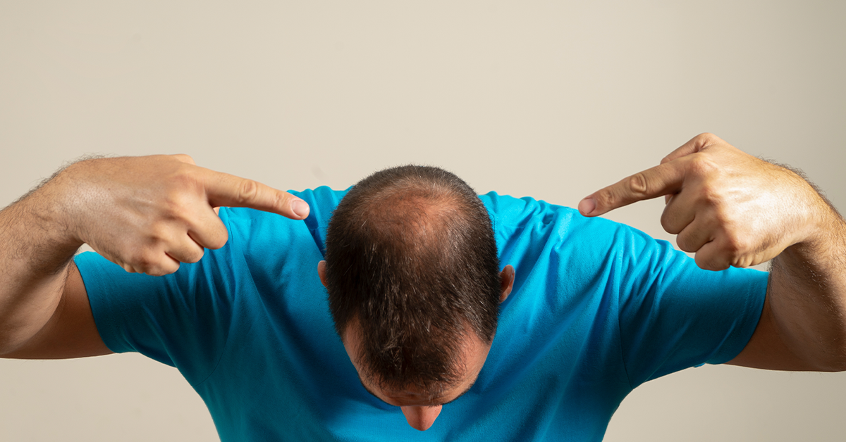 how to stop hair loss in teenage guys