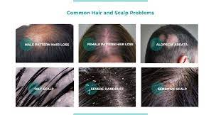 Common Hair Problems and Solutions